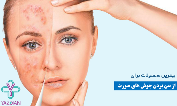 ضد جوش صورت